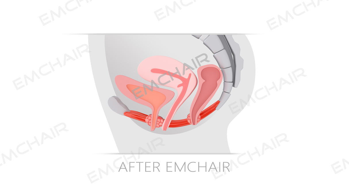 Uno Vita's EM Chair Pro Pelvic Floor Stimulation