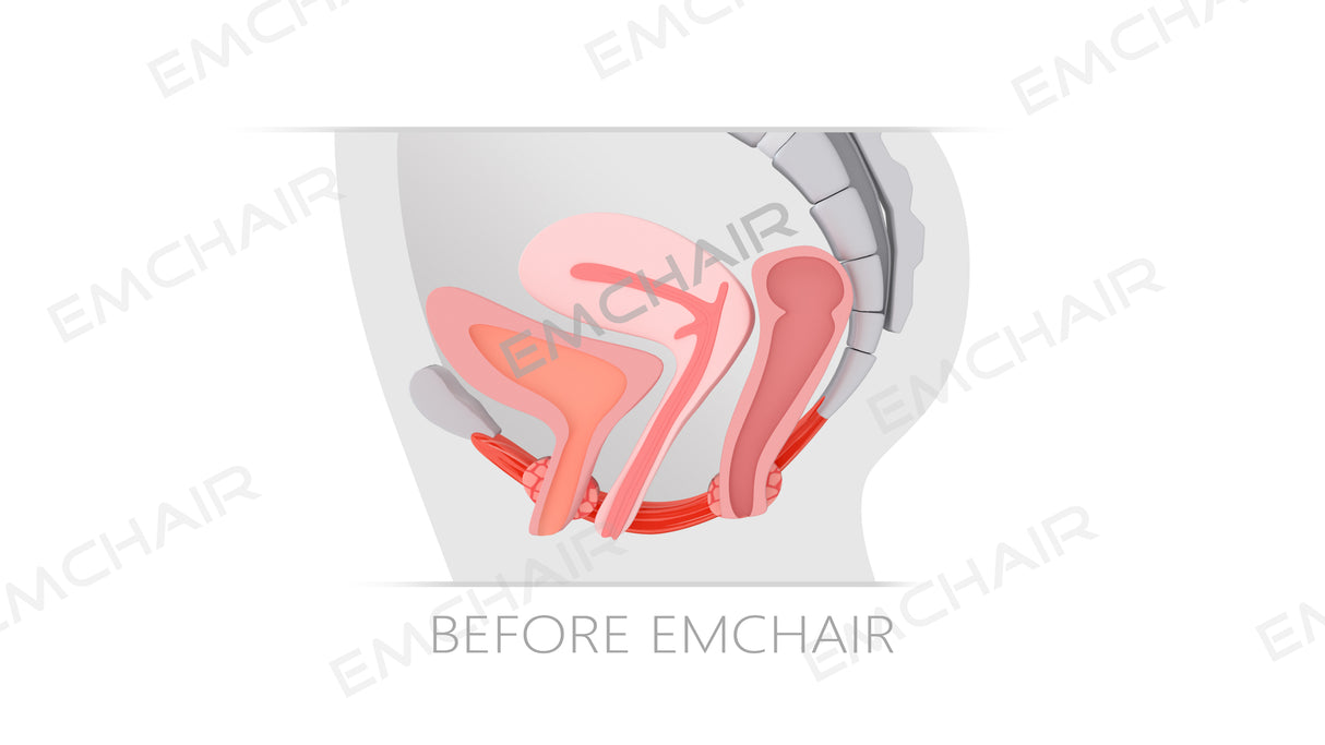 Uno Vita's EM Chair Pro Pelvic Floor Stimulation