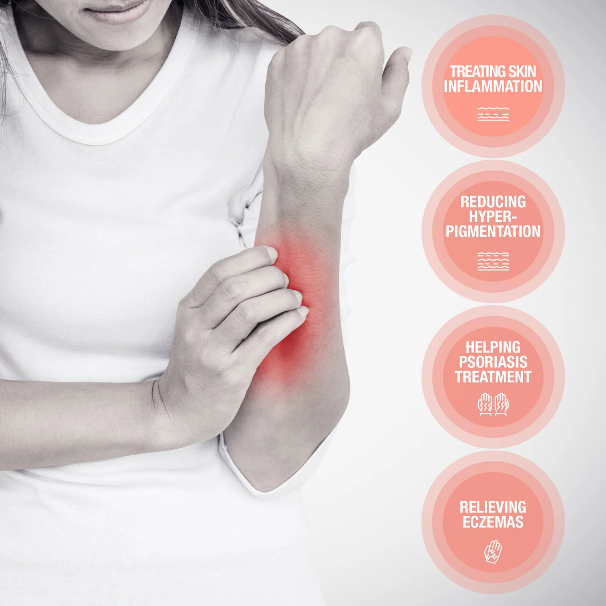 OLIVIE DERMAPSORIA - Fight Psoriasis and Eczema NATURALLY!