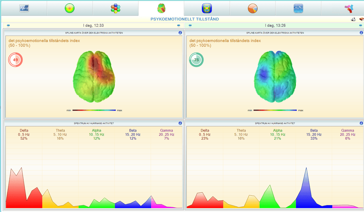 Alfa HRV - and energy diagnostic system - Uno Vita AS