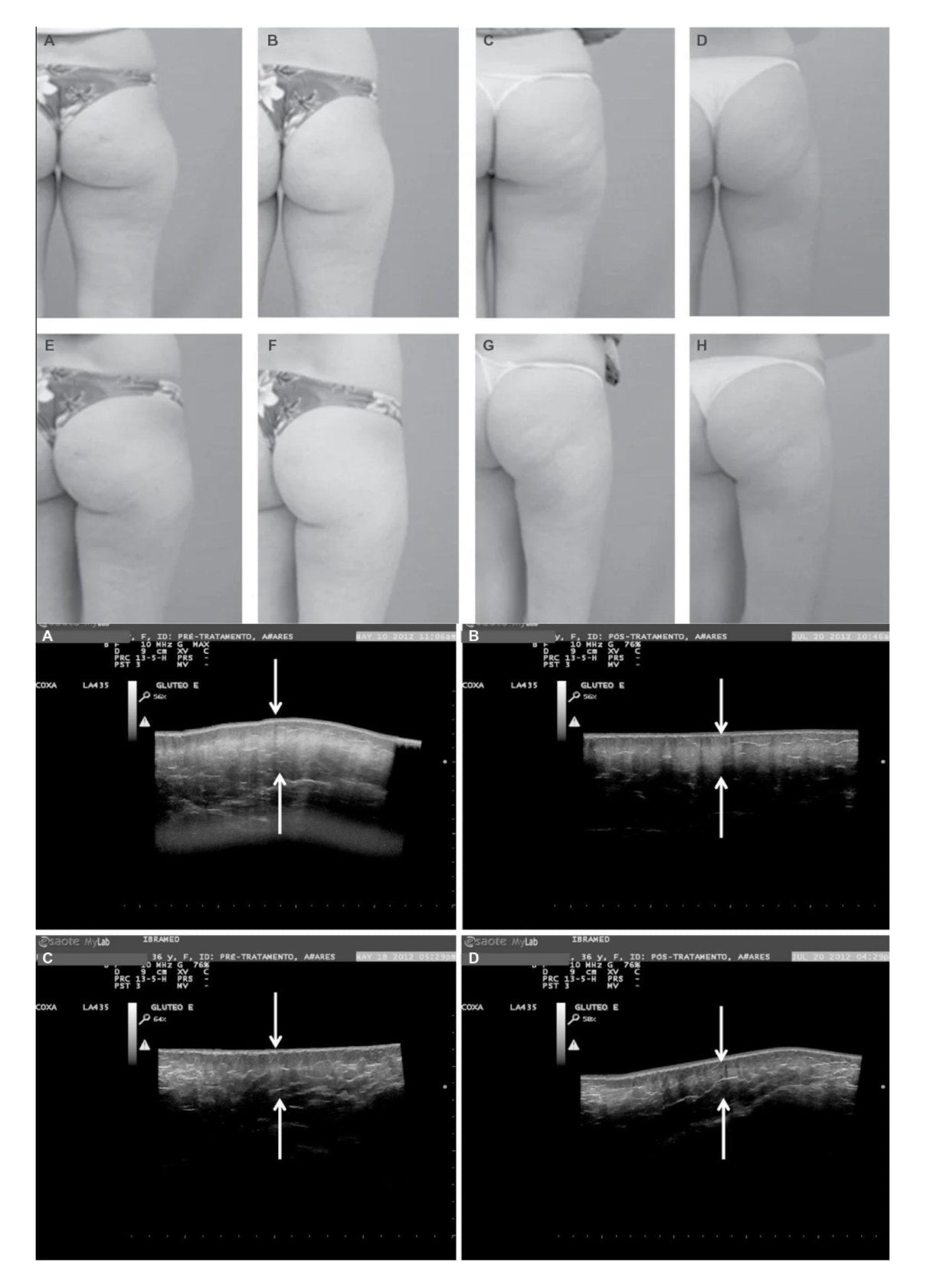 Terapia BodyStream Co2 (grande) - Uno Vita AS