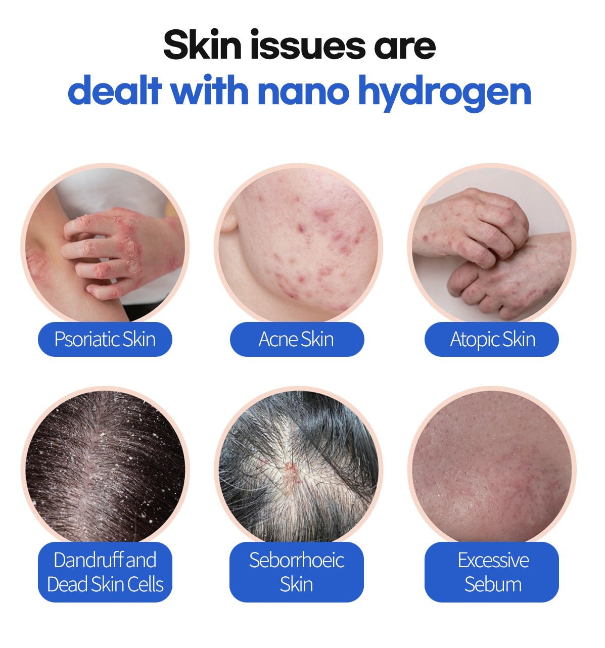 Hue Light Nanobubble Hydrogen SPA Generator – Uno Vita AS