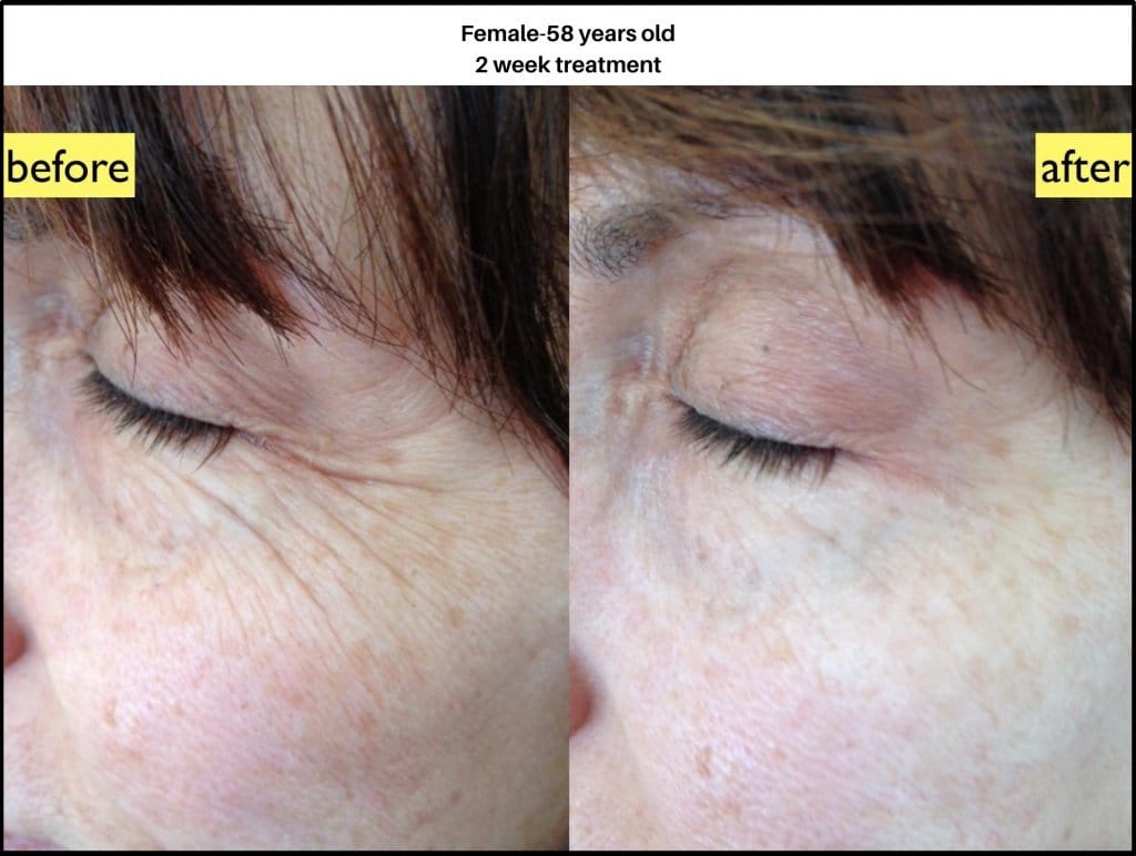 Crème Peau Naturelle Nano Soma - Uno Vita AS