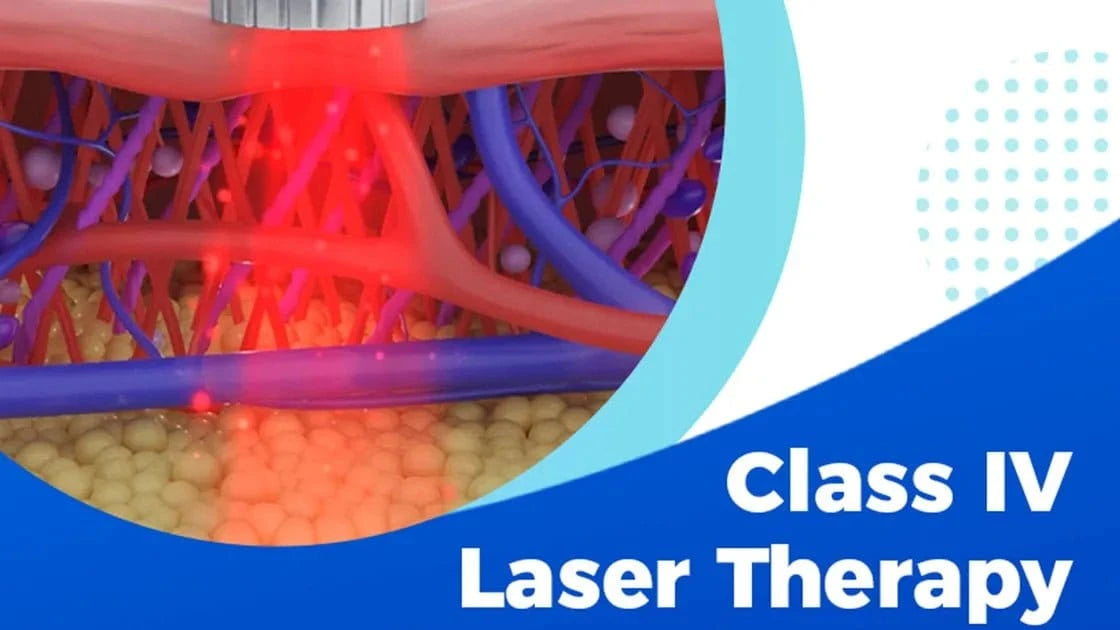 Smart Ice Class 4 Laser Therapy System (Klasse IV professionel laserterapi) - Uno Vita AS