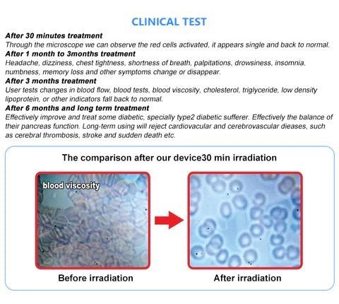 Uno Vita 4 Farblaser (LLLT) Therapieuhr – Uno Vita AS