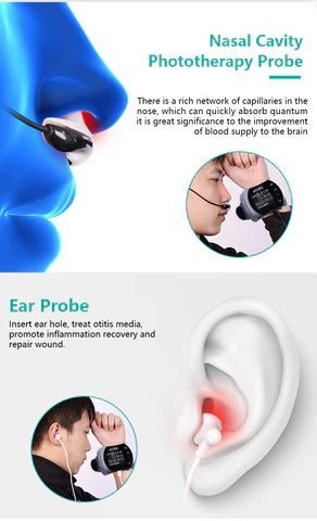 Uno Vita 4 Farblaser (LLLT) Therapieuhr – Uno Vita AS