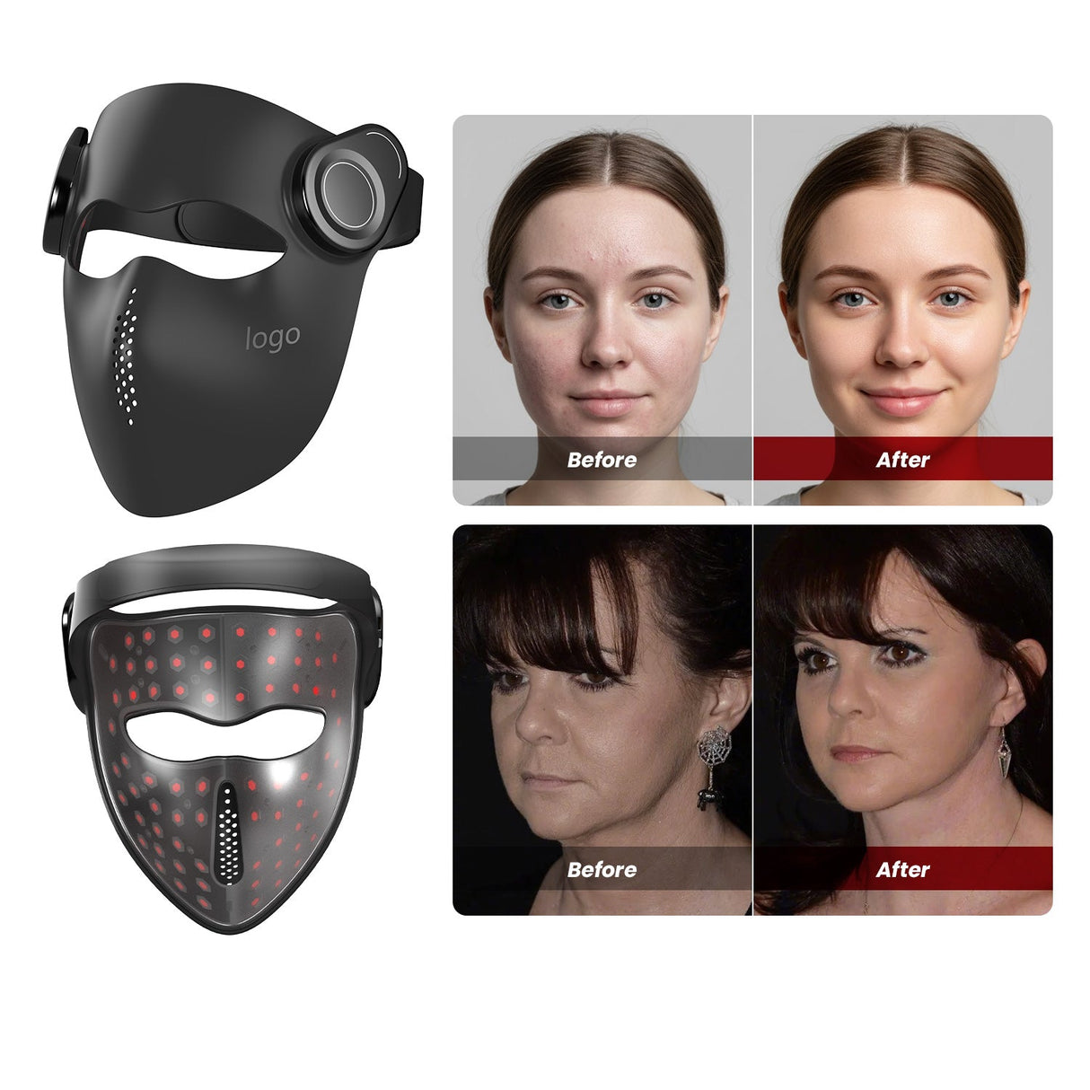 Uno Vita Pro Light Mask 1064 – medical grade wireless LED + laser therapy mask - Uno Vita AS