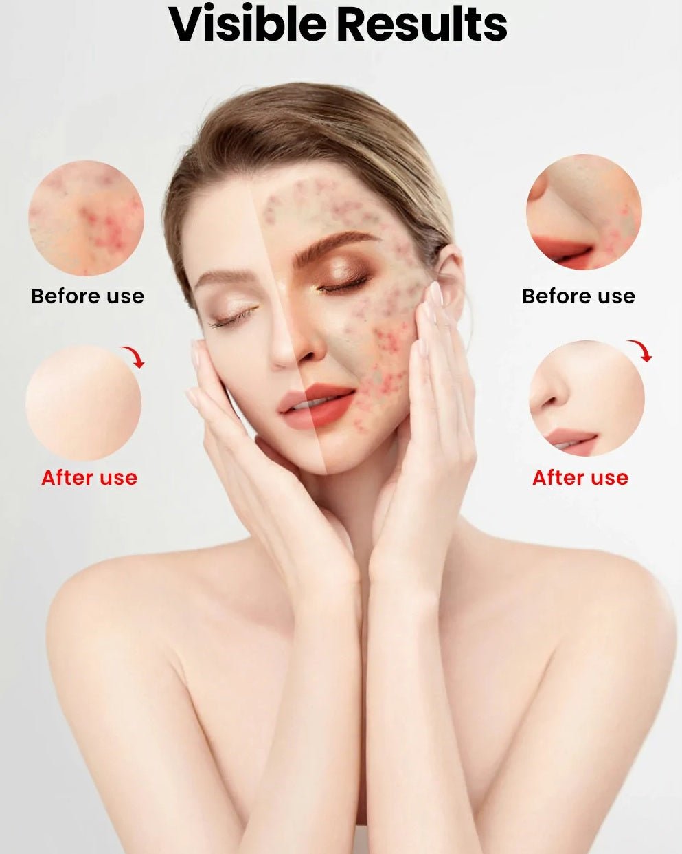 Uno Vita`s Advanced Beauty LED Light Therapy Facemask TLM200 - K 510 - Uno Vita AS