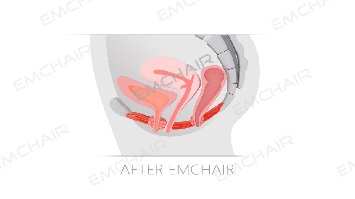 EM Chair Pro Beckenbodenstimulation von Uno Vita – Uno Vita AS