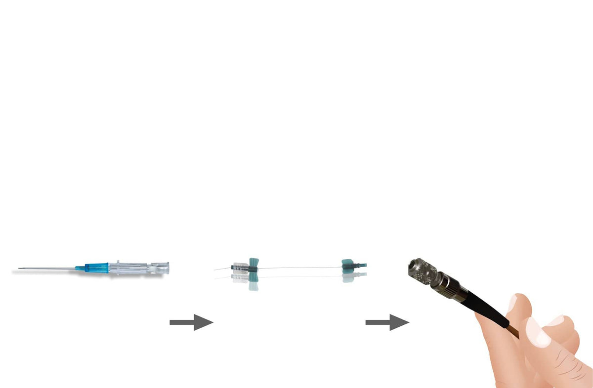 Weberneedle® Endo レーザー システム - Uno Vita AS