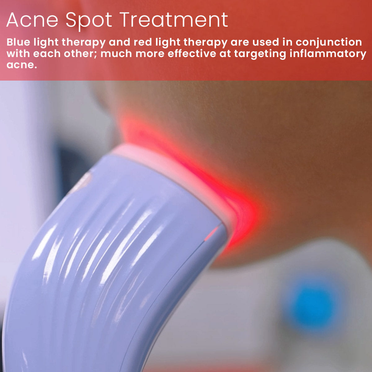 Dispositif de soins de la peau de la lumière et de la luminothérapie en rouge et bleu de Uno Vita