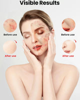 Uno Vita's Advanced Beauty LED Light Therapy Facemask TLM200-K 510