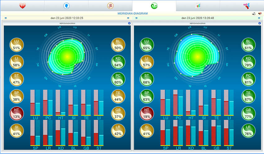 Alfa HRV -og energi diagnostikksystem - Uno Vita AS