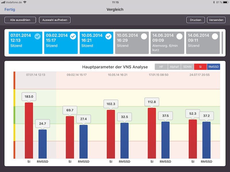 ANS Analysis Professional (HRV) - Uno Vita AS