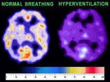 BodyStream Co2 terapi (medium) - Uno Vita AS