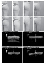 BodyStream Co2-terapi (medium) - Uno Vita AS