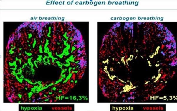 Carbogen inhalator (Co2-andning) - Carbogenetics - Uno Vita AS