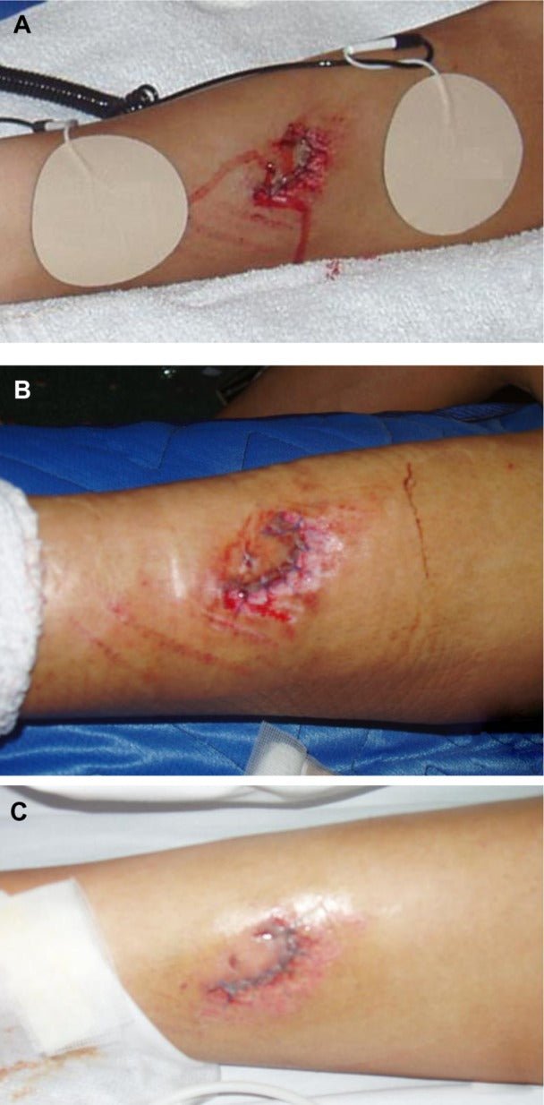 Earthing High - Silver Fitted Grounding Sheet (152x203cm) - Uno Vita AS