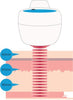 Handy Cure S pulserende laser - Uno Vita AS