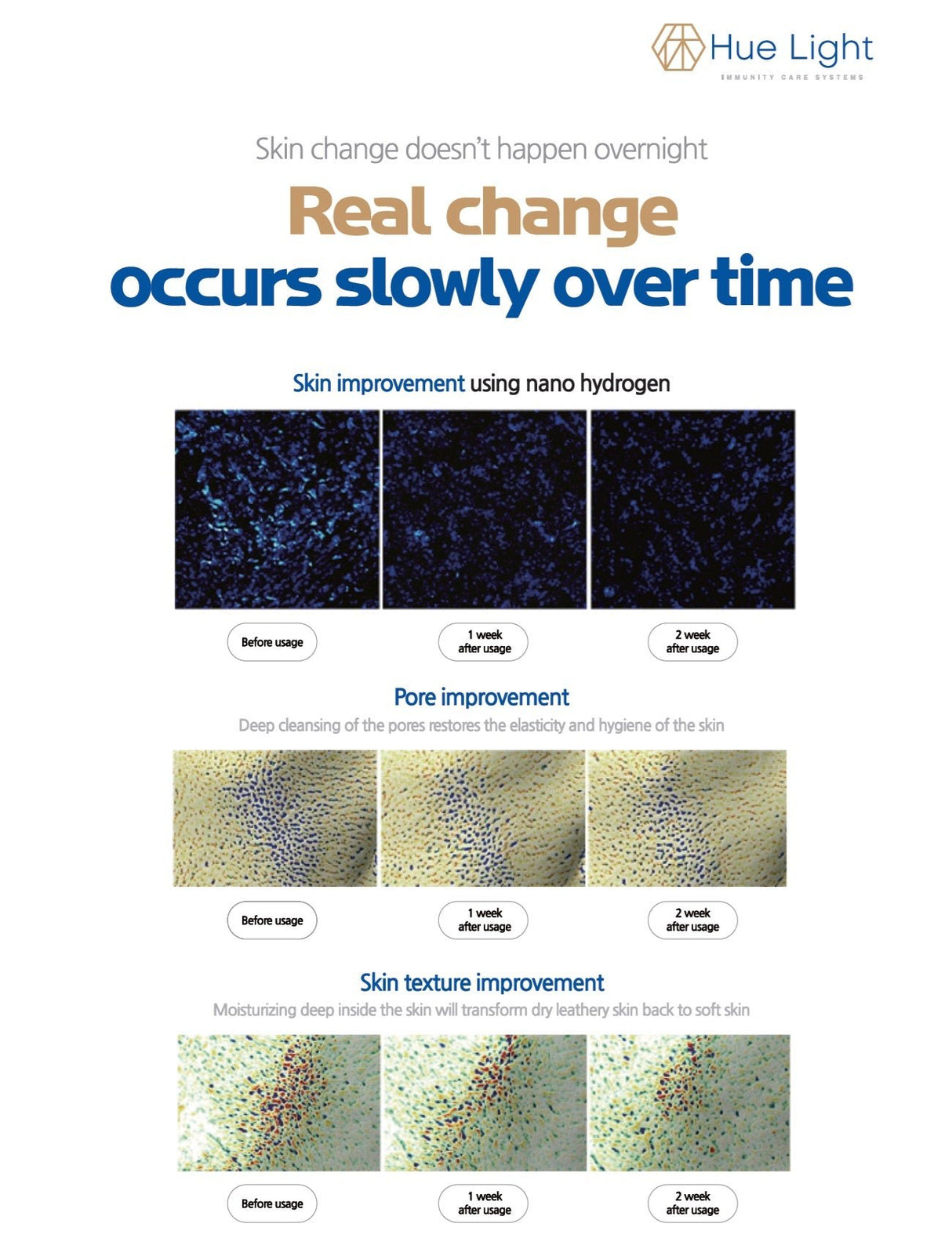 Hue Light Nanobubble Hydrogen SPA Generator – Uno Vita AS