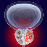 Plant Sterols – Beta-Sitosterol - Uno Vita AS