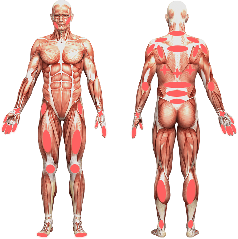 Power Cure Pro Laser - Uno Vita AS