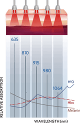 Smart Ice Class 4 Laser Therapy System (klass IV professionell laserterapi) - Uno Vita AS