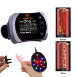 Uno Vita 4 Color Laser (LLLT) therapy Watch - Uno Vita AS