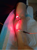 Weberneedle® Endo laser system - Uno Vita AS