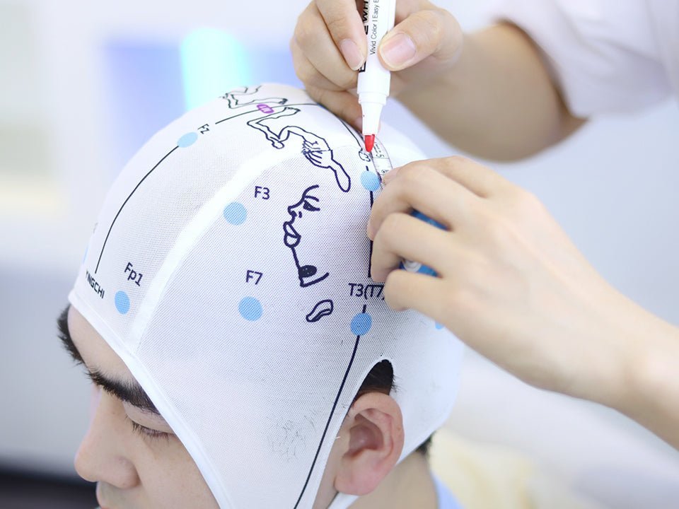 YINGCHI – rTMS (Transkranielle Magnetstimulation) – Uno Vita AS