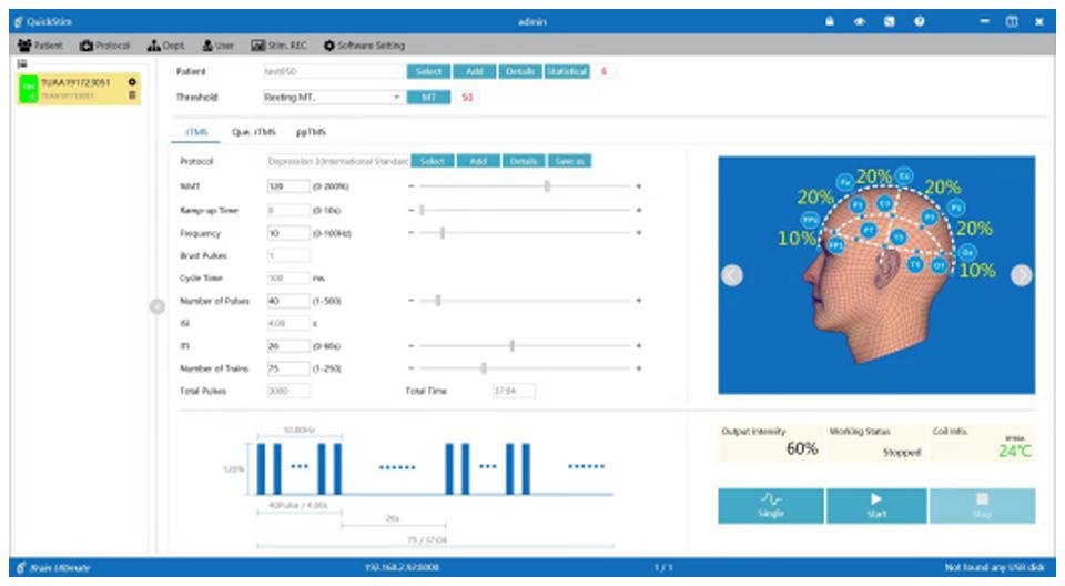 YINGCHI – rTMS (Transkranielle Magnetstimulation) – Uno Vita AS